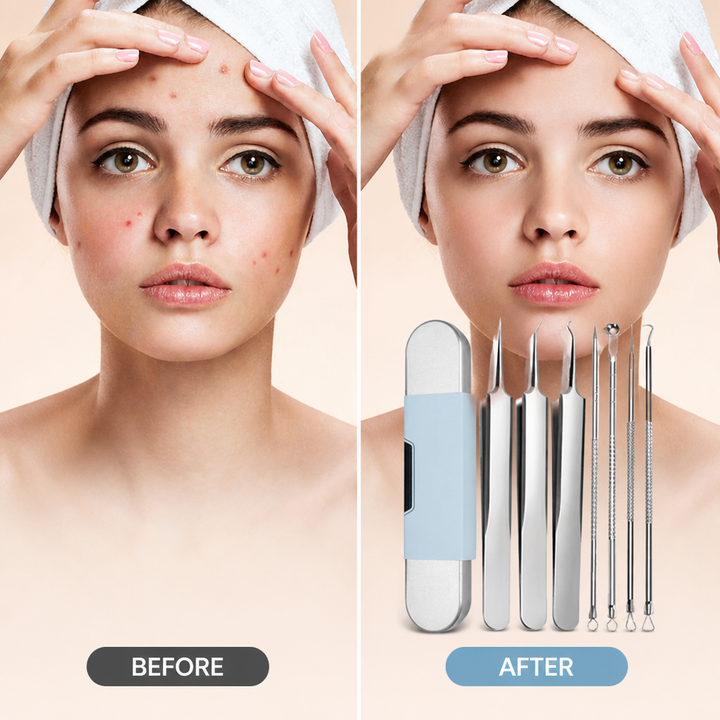 Comparaison avant-après sur le visage d'une femme : peau avec boutons à gauche, peau nette à droite, avec le kit en incrustation. 4