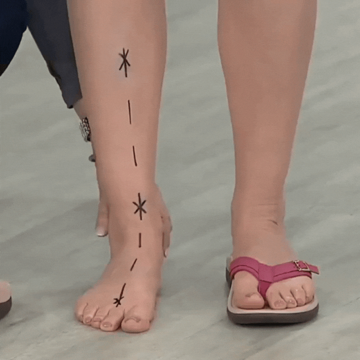 Jambe marquée de traits au feutre à côté d'un pied portant une tong rose à boucle 1