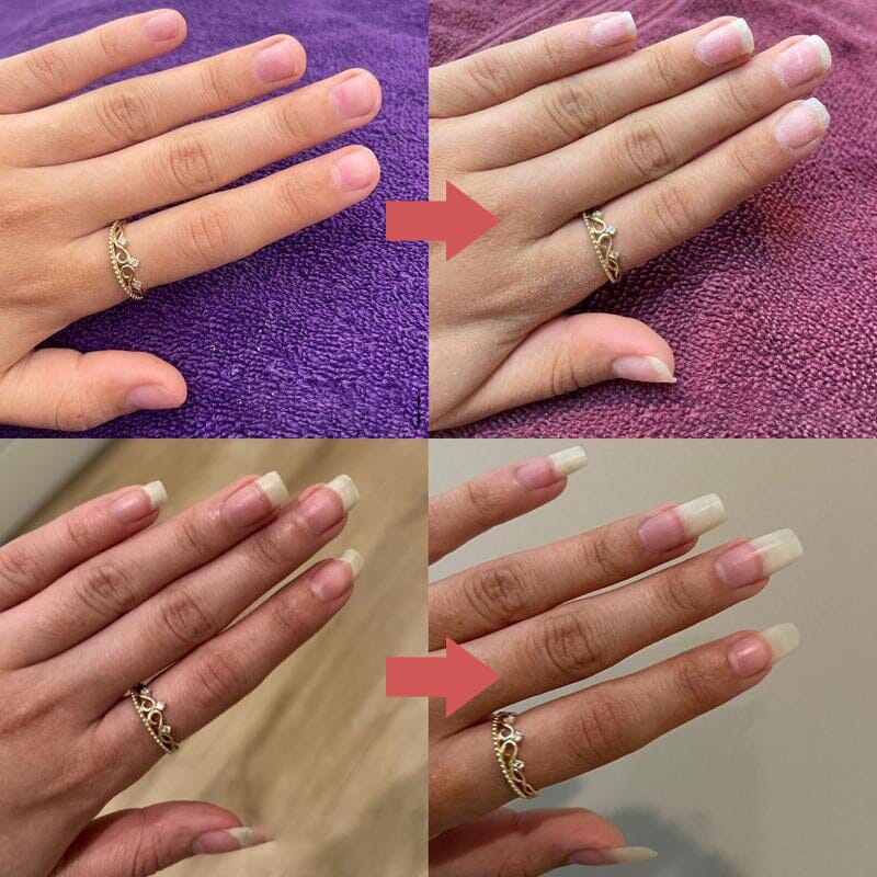 Deux comparaisons avant-après d'une main portant une bague, ongles plus longs et soignés après utilisation 9