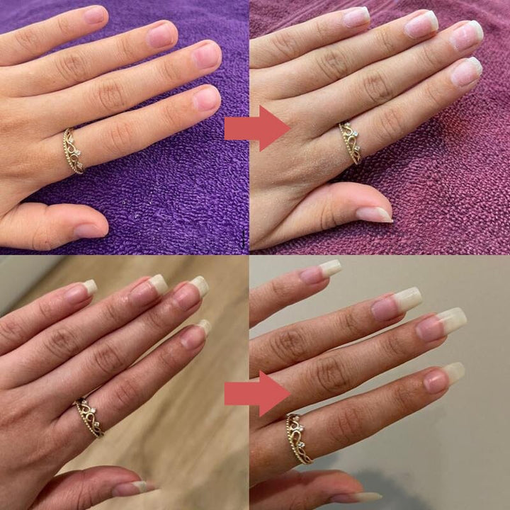 Deux comparaisons avant-après d'une main portant une bague, ongles plus longs et soignés après utilisation 9