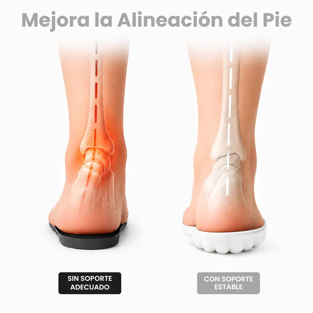 Comparaison de deux pieds vus de dos, l'un sans soutien avec cheville douloureuse, l'autre avec semelle blanche et alignement stable. 2