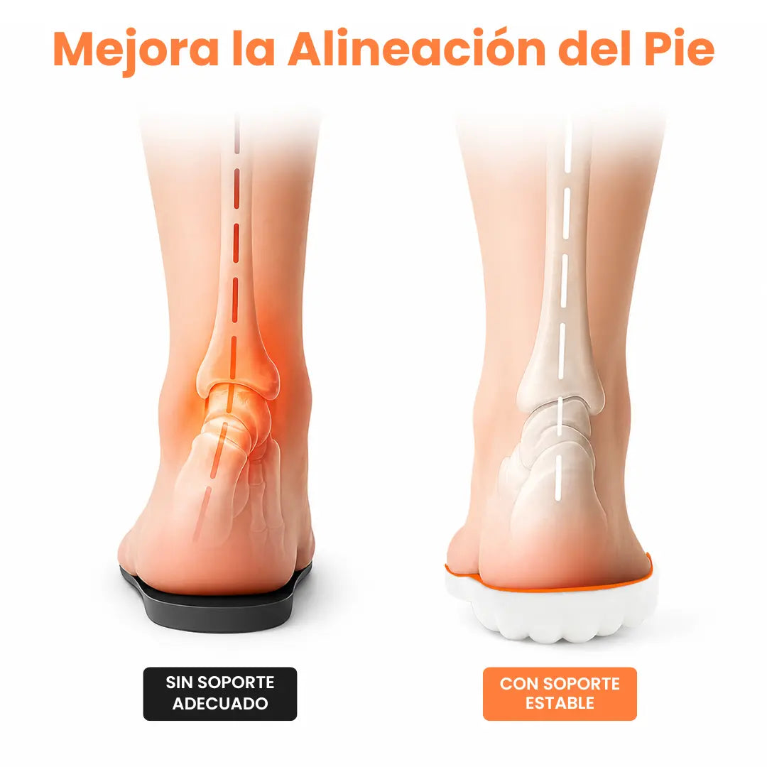 Comparaison de deux pieds vus de dos, avec ou sans soutien, la semelle orange et blanche stabilisant l'alignement de la cheville. 7