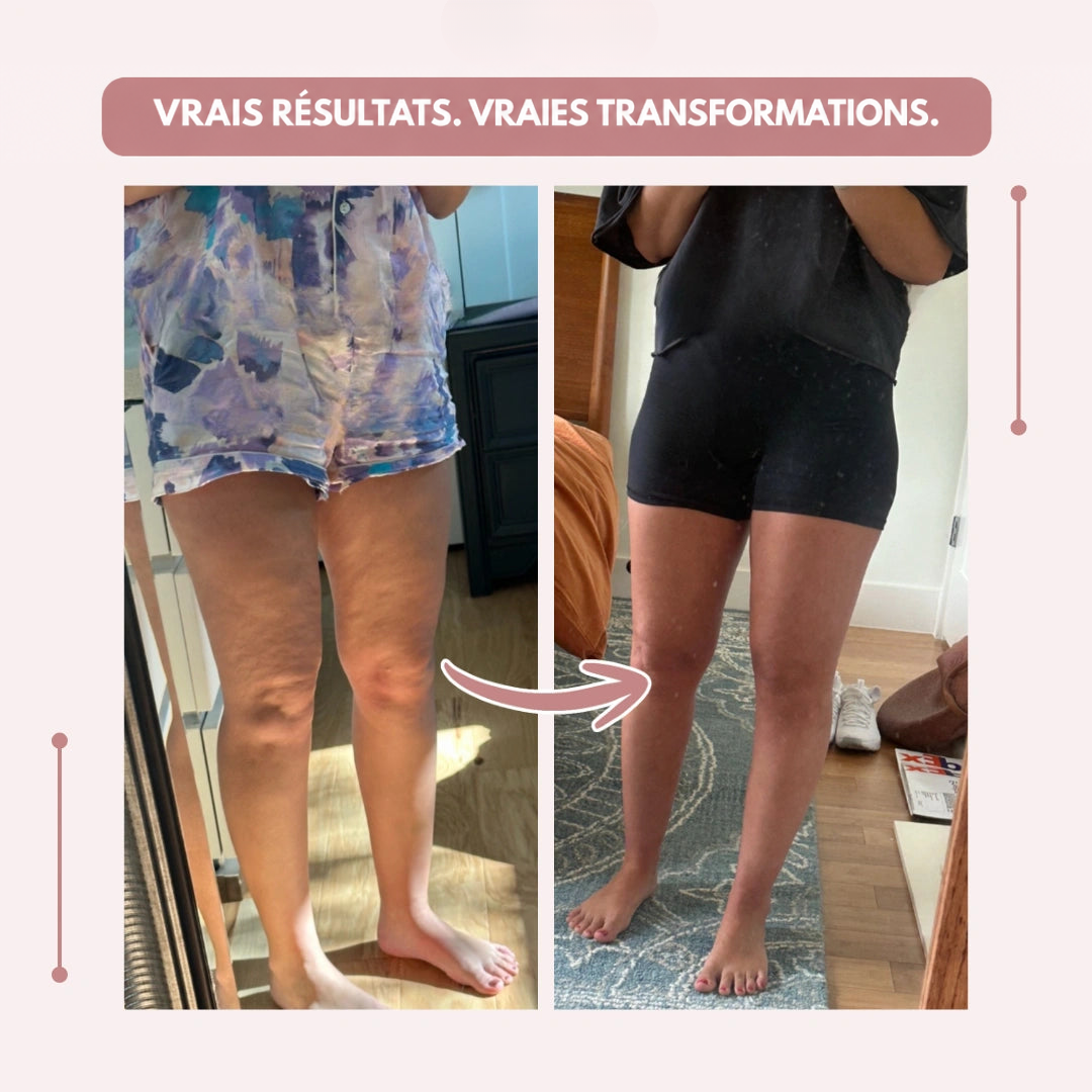 Visuel avant-après de jambes photographiées dans un miroir, pyjama à motifs à gauche et short noir ajusté à droite. 19