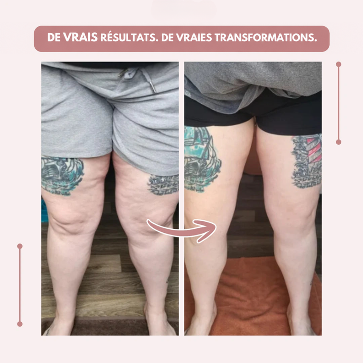 Visuel avant-après de cuisses tatouées vues de face, le short gris laissant place à un short noir, sur fond rose pâle. 18