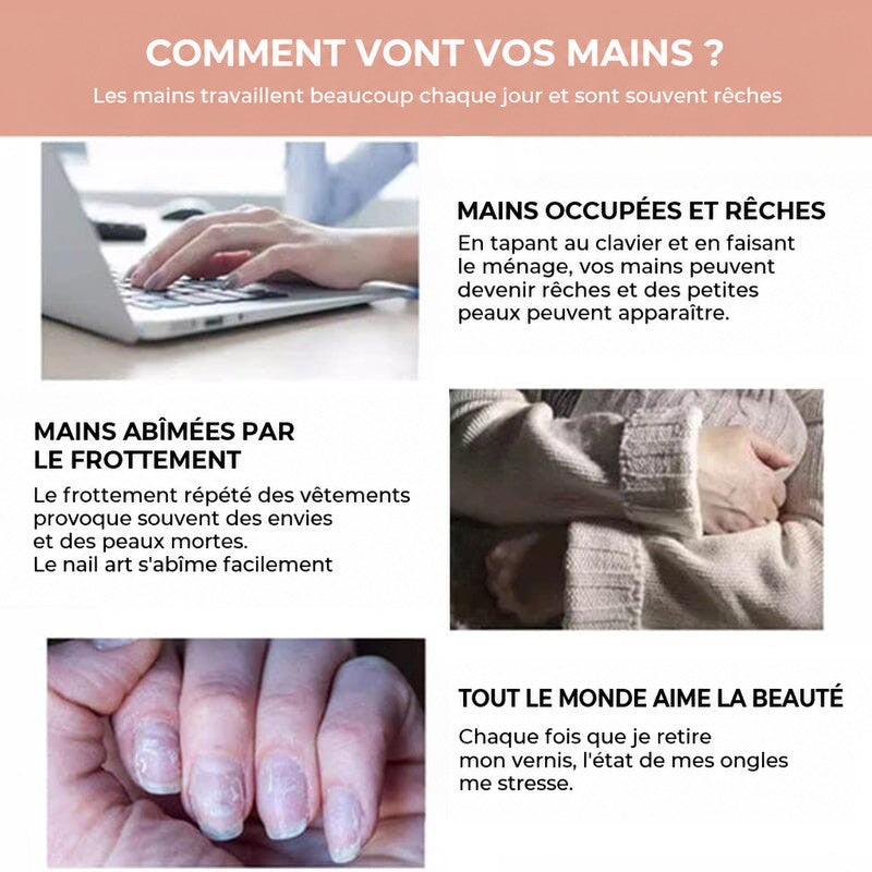Trois situations du quotidien abîmant les mains: clavier d'ordinateur, frottement du pull et ongles abîmés 6