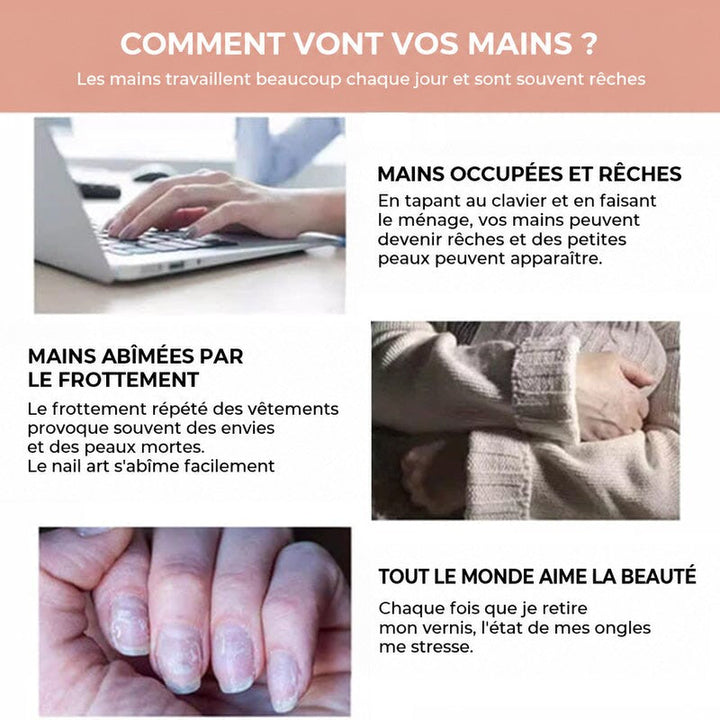 Trois situations du quotidien abîmant les mains: clavier d'ordinateur, frottement du pull et ongles abîmés 6