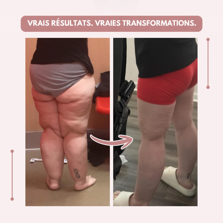 Visuel avant-après montrant les jambes d'une femme vues de dos, sans et avec une tenue ajustée, sur fond rose pâle. 10