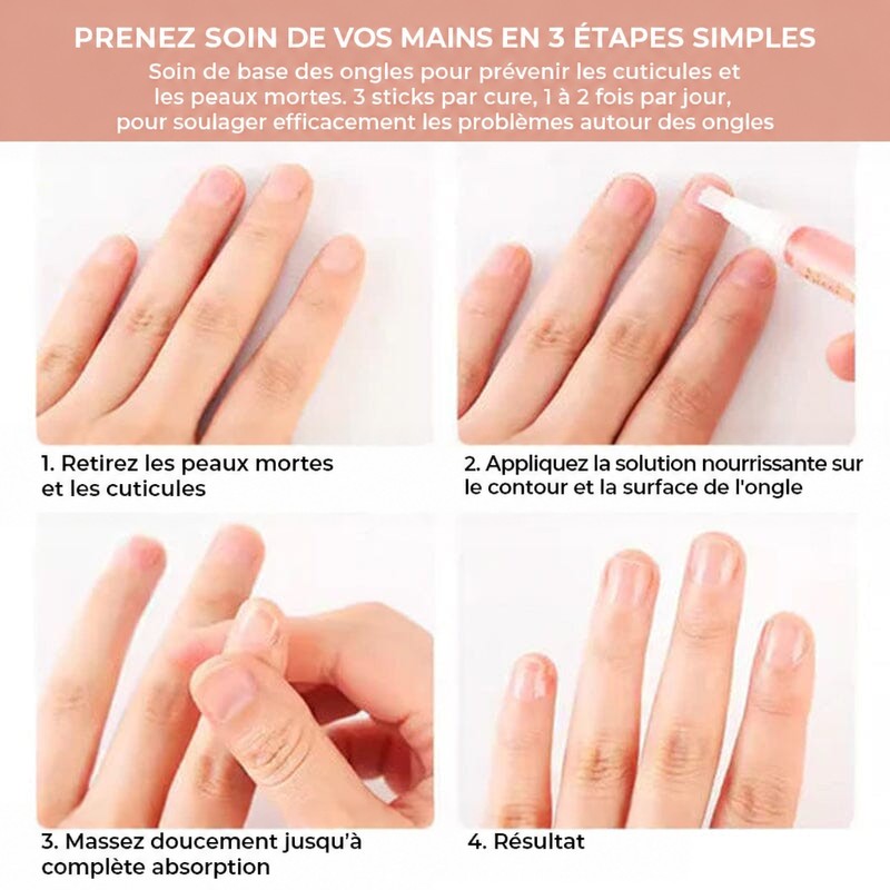 Quatre étapes d'utilisation du stylo sur des mains, de la peau retirée au résultat final 5