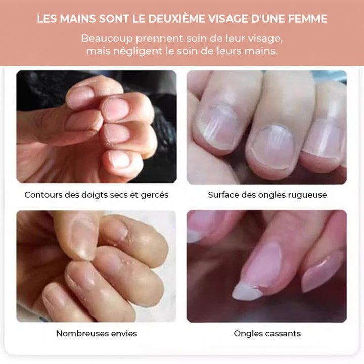 Quatre gros plans de problèmes de mains: peaux sèches, ongles rugueux, envies et ongles cassants 3