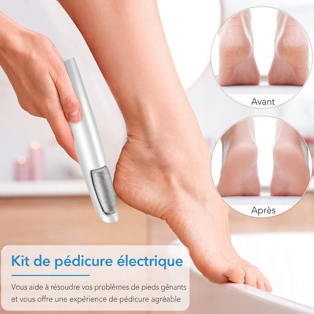Main tenant la râpe contre un talon, avec deux vignettes comparant des talons secs avant et lisses après utilisation. 2